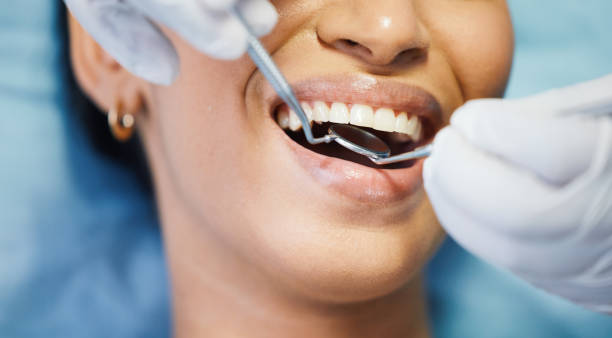 Best Emergency Cosmetic Dentistry (e.g., broken veneers) in Pacifi, CA