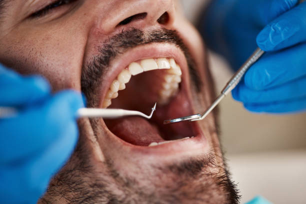 Best Emergency Pediatric Dental Care in Pacifi, CA