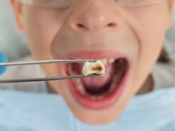 Best Emergency Treatment for Jaw Pain or Injury in Pacifi, CA